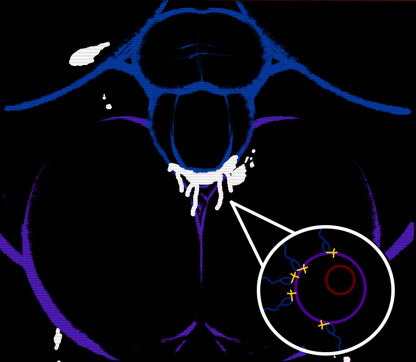 1boy 1girls aged_up amy_martin amy_ward ass blood blue_outline broccolistan cum cum_in_pussy cum_inside cum_on_ass cum_on_body cum_on_self faceless_female faceless_male faith_the_unholy_trinity father_john_ward female genital_focus good_end impregnation male male_on_top mating_press mawile123 minimalist_background naked_female naked_male ovum penetration penis purple_outline pussy sex sperm_cell spread_legs vaginal_penetration x-ray