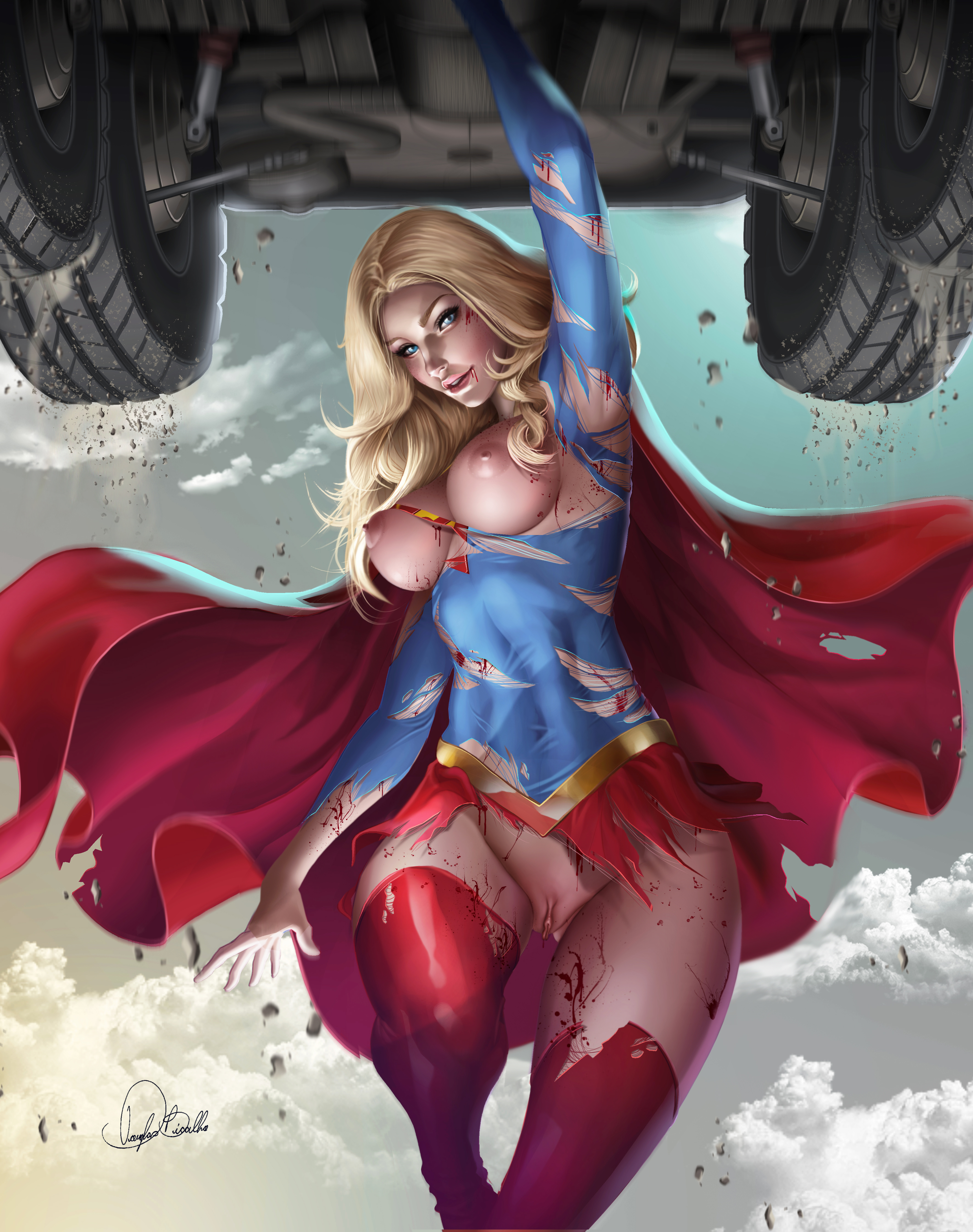 areolae, blonde hair, blood, blue eyes, bottomless, breasts, dc, dc comics, douglas bicalho, female, kara danvers, kara zor-el, naked, nude, pussy, pussy lips, ripped, ripped clothing, shaved pussy, supergirl, superman (series), vagina