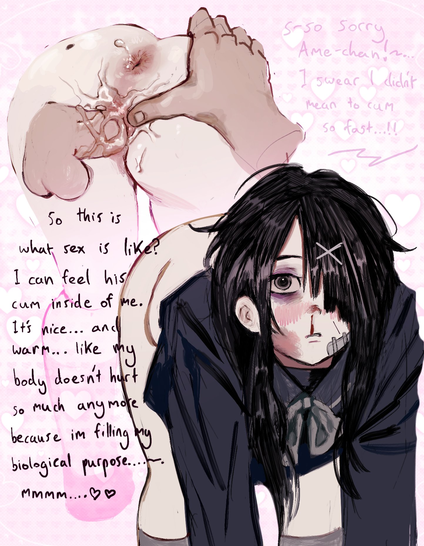 ame-chan, bandage, bandaid on face, bloody nose, bruise, bruises, cum in pussy, cum inside, eyebags, femcel, girlfailure, male penetrating female, needy girl overdose, ovulating, petwifeowner, submissive female, virgin, virginity loss