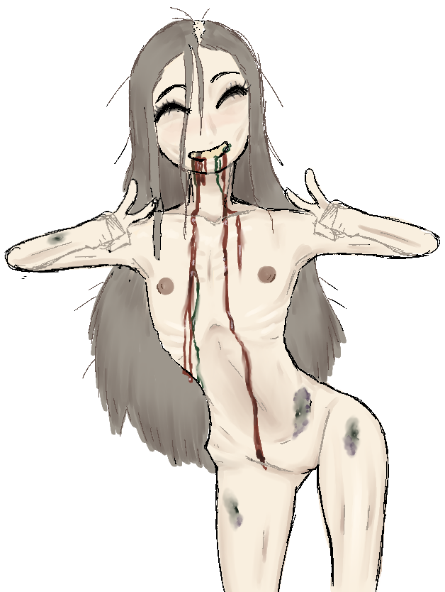 anorexia anorexic balding blood bruised colored dying eyebags flat_chest gore long_hair pale_skin peace_sign rough_sketch skinny sp4gh3tt1_(artist) vomit yellow_teeth