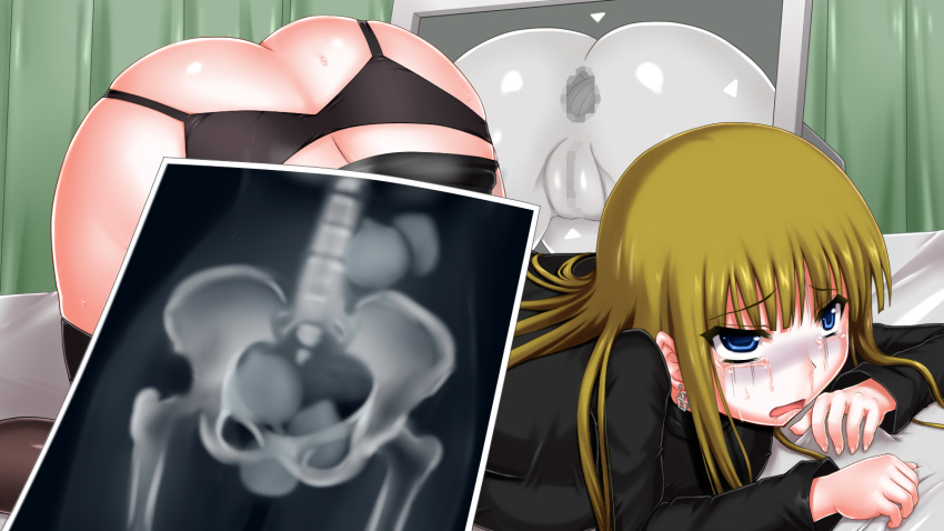 1girls ass ass_sweat ass_up blonde_hair censored crying embarrassed foreign_object garter_belt medical object_insertion onion patient pussy tears trubka x-ray