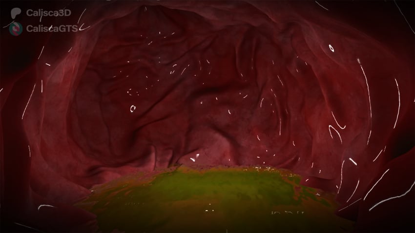 belly cave cavernous digest digested digesting digests endo gut peristalsis stomach stomach_acid stomach_acids stomach_noises tummy vore wet