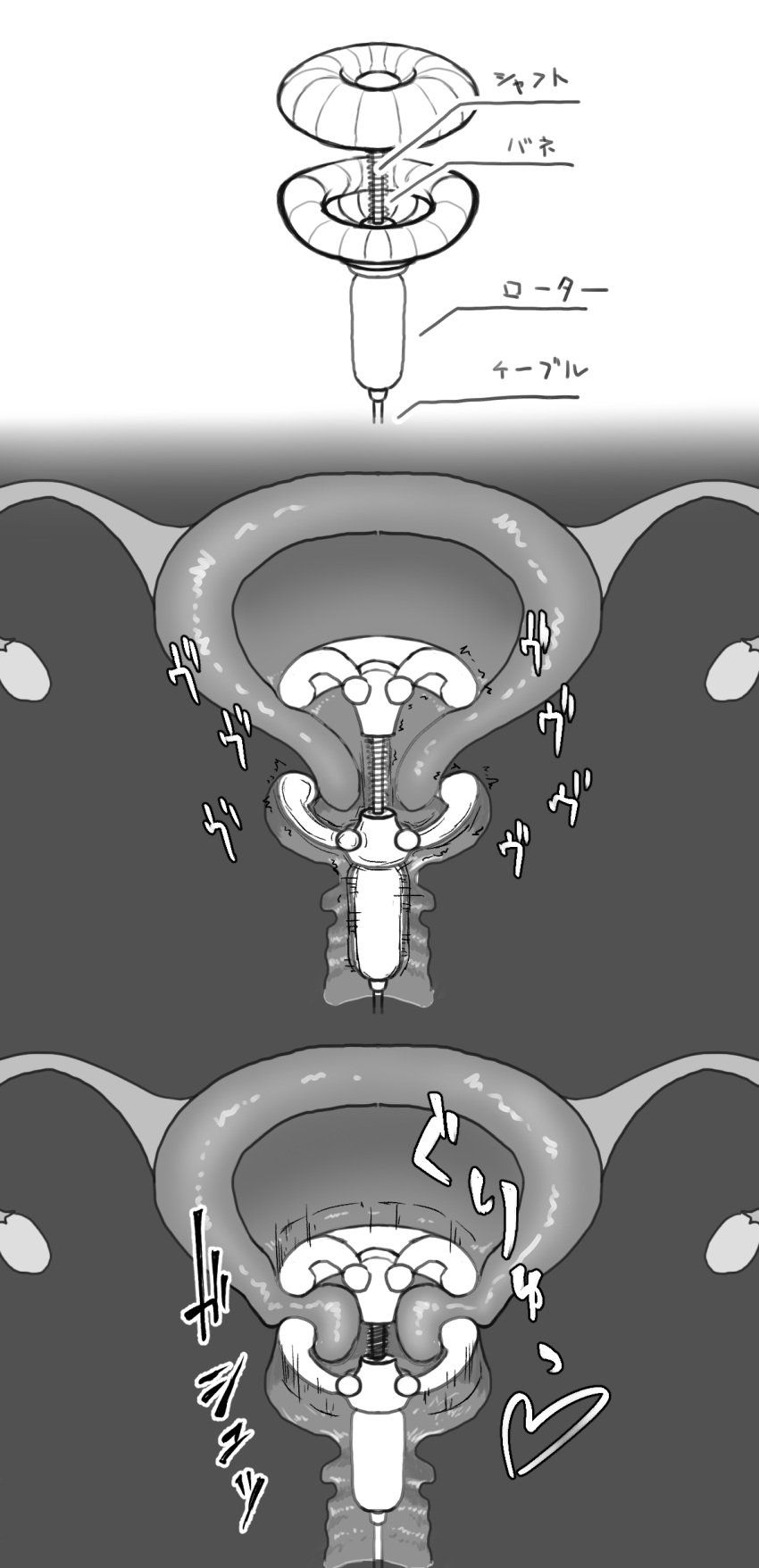 absurdres anatomy cable cervical_insertion cervix commentary cross_section daniel001raven diagram endometrium fallopian_tubes grey_background greyscale heart highres monochrome myometrium object_insertion original ovaries perimetrium rotor sex_toy spring_(object) translated uterus vibrator white_background