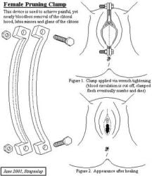 abuse abused_female anus chastity chastity_device education educational female_abuse female_genital_mutilation genital_mutilation permanent_chastity permanent_chastity_device pussy thighs torture torture_device vagina