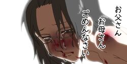 1girls black_hair blood bruise bruise_on_face crying female glasses injury maru_(314) nosebleed nude open_mouth original parted_lips simple_background solo tear text translated translation_request white_background