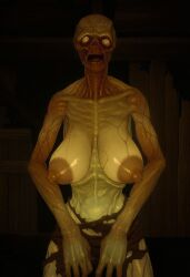 1girls ai_generated areola areolae big_breasts breasts breasts_apart creepy fallout female female_only feral_ghoul_(fallout) huge_breasts looking_at_viewer nipples ribs ripped_clothing solo teratophilia unknown_artist vein veins veiny_breasts white_eyes