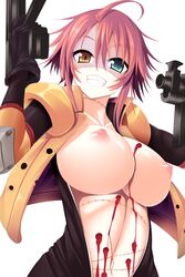 ahoge areolae bleeding blood breasts bullet_hole center_opening dual_wielding female green_eyes gun heterochromia large_breasts looking_at_viewer monster_musume_no_iru_nichijou navel nipples open_jacket pink_hair puffy_nipples smile solo stitches stomach sukage unzipped upper_body weapon wounded yellow_eyes zombie zombina