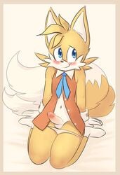 2015 anthro balls blue_eyes blush canine clothing cosplay cream_the_rabbit_(cosplay) crossdressing crossplay erection femboy fox fur furry furry_only furry_tail girly gloves kneeling legwear male male_only mammal miles_prower miles_tails_prower multiple_tails panties panties_down penis sega smile socks solo sonic_(series) sonic_the_hedgehog_(series) sparkydb tail tails tails_the_fox underwear