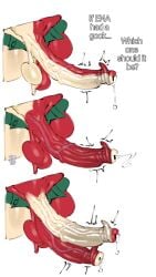 diphalism duo_penis ena ena_(dream_bbq) ena_(series) foreskin futa_only futanari large_penis leaking leaking_precum multi_genitalia multicolored_body multiple_penises red_body text toonguy100 veiny_penis