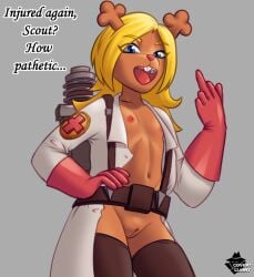 anthro anthro_focus anthro_only artist_name belly_button belt black_thighhighs blonde_hair brown_belt cleft_of_venus collarbone cosplay covertcunny cub deltarune dialogue english_text eyebrows eyelashes female female_anthro female_focus female_only flipping_off fur furry furry_female furry_only jacket jacket_open long_hair long_sleeves medic_(team_fortress_2) middle_finger navel nipples noelle_holiday open_mouth pussy red_cross red_gloves reindeer reindeer_antlers reindeer_humanoid signature sole_female solo solo_anthro solo_female solo_focus team_fortress_2 thighhighs tongue trenchcoat upper_teeth upper_teeth_only watermark white_jacket young