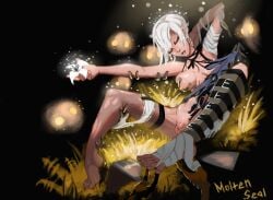 1girls android arms_behind_back bandage bare_shoulders barefoot dress_lift dress_pull feet feet_up female female_only flaccid foot_worship foreskin grass groping_breasts inspection intersex kaine_(nier) moltenseal_(artist) nier:_automata penis ripped_clothing ripped_pantyhose robot shaved_crotch short_hair small_breasts small_penis stripped sunlight toes_spread unconscious video_games white_body white_hair