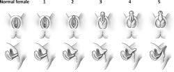 1girls 2girls 5girls 6girls anatomically_correct anatomy_chart article dickgirl female female_focus female_penis futa_focus futa_on_futa futa_sans_pussy futanari girl_only girlcock intersex multiple_girls only_female only_girl prader_scale_5_girl