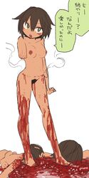 amputee annoyed annoyed_expression bags_under_eyes blood guro injury nipples nude ootorii_bisetsu open_mouth original pubic_hair severed_arm severed_limb short_hair simple_background standing translation_request white_background zombie zombie_girl