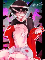 bandages bandaid bite_marks blood bruised cutting kagerou_project kisaragi_shintarou male_only mekakucity_actors scissors self_harm