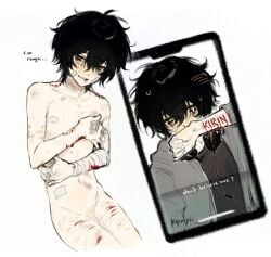 1boy artist_name bad_source bandage_on_cheek bandage_on_finger bandaged_arm bandaged_hand bandages bandaid bite_mark bite_mark_on_arm bite_mark_on_shoulder black_hair blood blood_drip bloody_bandage blush bruise bruised_neck bruised_stomach completely_nude cuts degrees_of_lewdity english_text flaccid green_eyes headphones headphones_around_neck injury jacket koinurin kylar_(degrees_of_lewdity) kylar_(male)_(degrees_of_lewdity) looking_at_viewer male male_focus masochism multiple_scars multiple_views nude pale_skinned_male reverse_ryona scar scratches self-harm self_shot selfie short_hair simple_background skinny smile snapchat sweat sweatdrop twink white_background young