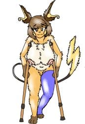 2023 alpha_channel anthro big_breasts breasts broken_leg cast crutch faelocke female fluffy generation_1_pokemon genitals hi_res julia_sparks_(faelocke) leg_cast medical_instrument nintendo nipples pokemon pokemon_(species) pokemorph raichu scientific_instrument vulva