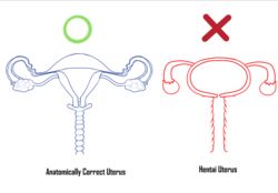 anatomically_correct anatomically_correct_uterus anatomically_incorrect crossman educational endometrium fallopian_tubes female fimbria genitals how-to labia_minora myometrium no_humans ovaries perimetrium pussy tutorial uterus