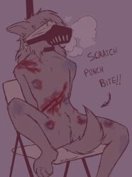 andromorph andromorph_anthro anthro biped bite_mark blindfold blood bodily_fluids bound bruised bruised_arm bruised_belly bruised_leg canid canine canis clitoral_hood collar collar_mutt domestic_dog genitals gore hair hi_res humanoid_genitalia humanoid_vulva intersex intersex_anthro mammal muzzle_(object) pubes scratch_mark scratches sitting solo trans_(lore) trans_man_(lore) vulva