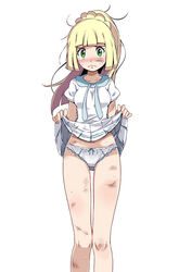 1girls aqua_bow bangs bare_legs blonde_hair blunt_bangs blush bow bruise creatures_(company) crying crying_with_eyes_open cuts dirty dirty_face dress female female female_only game_freak green_eyes high_ponytail injury lillie_(pokemon) long_hair looking_at_viewer nail_polish nintendo panties pleated_dress pleated_skirt pokemon pokemon_(game) pokemon_sm shirt short_sleeves sidelocks simple_background skirt skirt_lift sole_female solo solo_female sweatdrop tears tsukishiro_saika underwear white_background white_panties white_shirt white_skirt