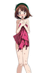 1girls :o bangs bare_arms bare_legs bare_shoulders beret blush breasts brown_eyes brown_hair bruise collarbone covering covering_body creatures_(company) crying crying_with_eyes_open cuts dress female female_only game_freak gloria_(pokemon) green_headwear hat injury looking_at_viewer medium_breasts medium_hair messy_hair nintendo open_mouth pink_dress pokemon pokemon_(game) pokemon_ss short_brown_hair simple_background solo solo_female sweat tears tsukishiro_saika upper_teeth white_background wide-eyed