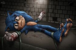 1boy 5_toes anthro barefoot blood blue_fur bondage bruise gloves gloves_only green_eyes male_only micropenis movie_sonic restrained sonic_the_hedgehog_(film) super_kubo tears