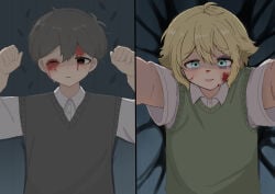 2boys absurdres antenna_hair basil_(faraway)_(omori) basil_(omori) black_eyes black_hair black_sweater_vest blonde_hair blood blood_on_face blue_eyes bruise bruised_eye collared_shirt commentary_request double-parted_bangs green_sweater_vest guro hair_between_eyes highres injury male_focus multiple_boys omori one_eye_closed parted_lips shirt short_sleeves sidelocks spoilers sunny_(omori) sweater_vest white_shirt yuuabara