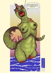 Amputation Rule 34 Image