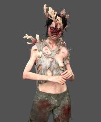 big_thighs blood body_horror breast cordyceps detailed_background female female_only fungus hair infected monster naughty_dog nipple nude open_mouth ribs screencap small_breasts solo sony_interactive_entertainment stalker_(the_last_of_us) teeth the_last_of_us the_last_of_us_2