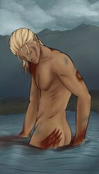 1boy blood bruised dragon_age dragon_age_origins elf male male_only solo tagme wounded zevran_arainai