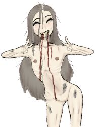 anorexia anorexic balding blood bruised colored dying eyebags flat_chest gore long_hair pale_skin peace_sign rough_sketch skinny vomit yellow_teeth