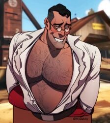 bara bara_tiddies bara_tits barazoku big_pecs burly_beast dilf doctor_sex egabbacc hairy_chest hairy_male himbo man_boobs medic_(team_fortress_2) official_alternate_costume pecs pectorals ripped_clothing ripped_shirt solo_male team_fortress_2