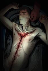 2boys absurdres blood brown_hair collarbone commentary corpse death dissection english_commentary fingernails gloves guro highres human human_only lying male_death male_focus medic_(tf2) multiple_boys nipples nude oblique-lane on_back out_of_frame red_gloves red_medic_(tf2) scout_(tf2) short_hair solo_focus team_fortress_2