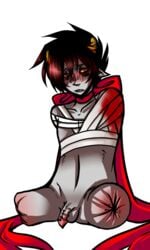 1boy amputee bandage blood blush bow grey_skin homestuck horns karkat_vantas ms_paint_adventures naked penis pointy_ears pride red_eyes red_hair sharp_teeth short_hair solo transparent_background troll weird_penis