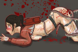 1girls ass backpack bag bandage beige_skin black_hair bleeding blood blood_stain bloody_bandage bloody_clothes blue_eyes blush breasts clothes color dirty_clothes dream4live ears exposed_breasts eyes female first_aid_kit gore hair hoodie human incision injury left_4_dead mouth open_eyes open_mouth outerwear round_ears side_view skin smoker_(left_4_dead) stained_clothes tear tentacle torn_clothes wound zoey_(left_4_dead) zombie